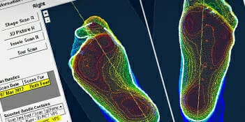 ADVANCED FOOT CARE TECHNOLOGY -  Caledon and Kleinburg Foot Care Clinic ADVANCED FOOT CARE TECHNOLOGY - Caledon and Kleinburg Foot Care Clinic