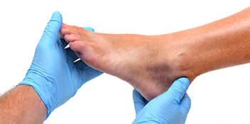 COMPLETE FOOTCARE SOLUTIONS - Caledon and Kleinburg Foot Care Clinic COMPLETE FOOTCARE SOLUTIONS - Caledon and Kleinburg Foot Care Clinic